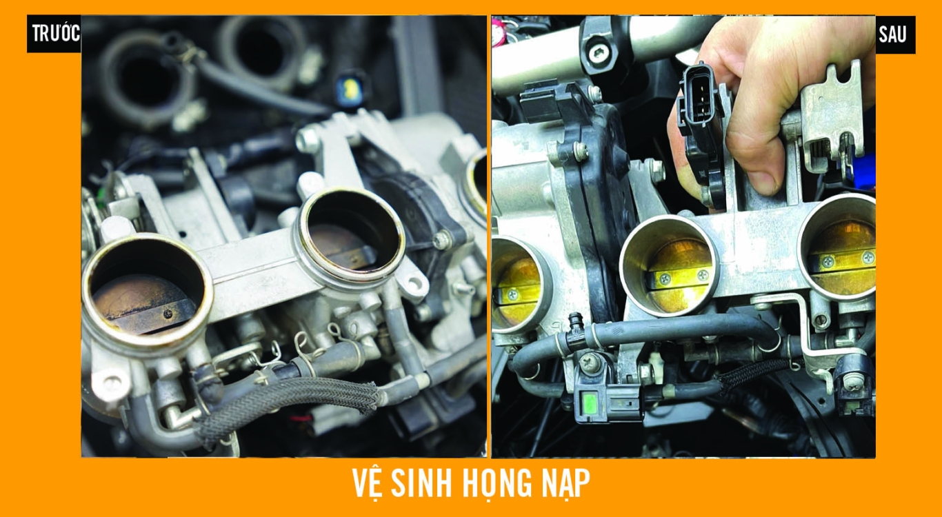 Vệ sinh họng nạp